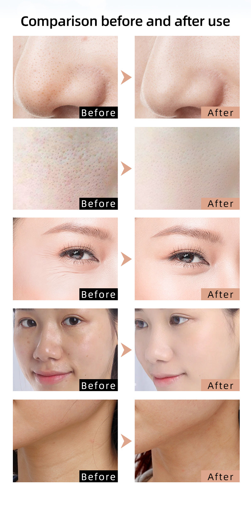Mascarilla portátil LED de fotones para el rejuvenecimiento facial y del cuello.