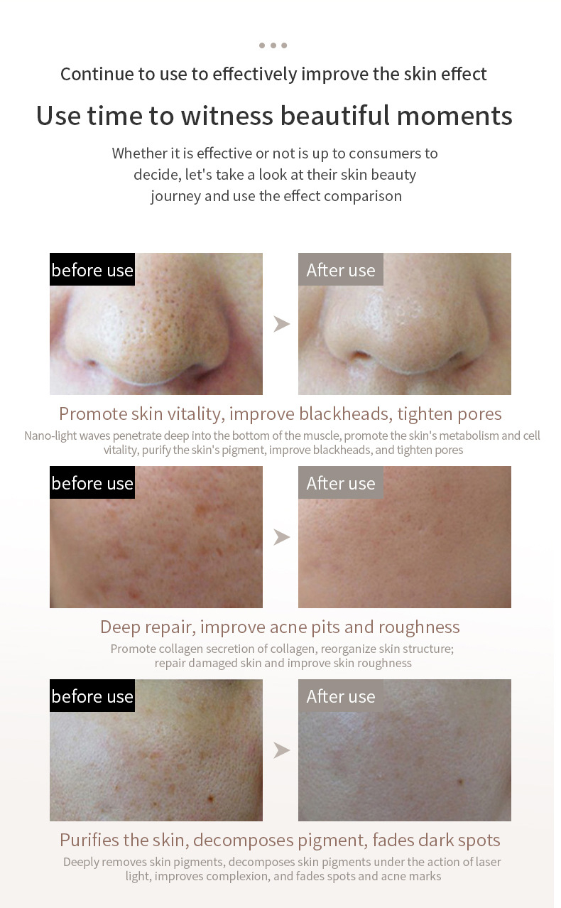 Mascarilla facial de terapia de luz LED - Rejuvenecimiento de la piel con 7 colores
