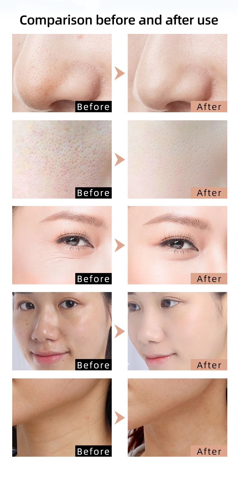 Masque portable de rajeunissement de la peau par photons LED pour le visage et le cou