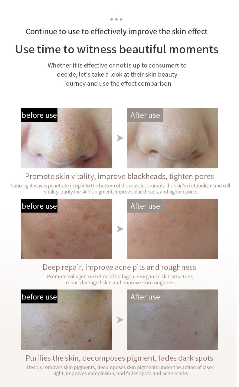 Masque facial de luminothérapie LED - Rajeunissement de la peau par 7 couleurs