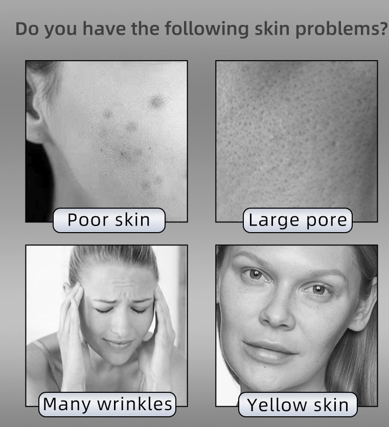 Ensemble de masques de rajeunissement de la peau par photons LED pour le visage et le cou