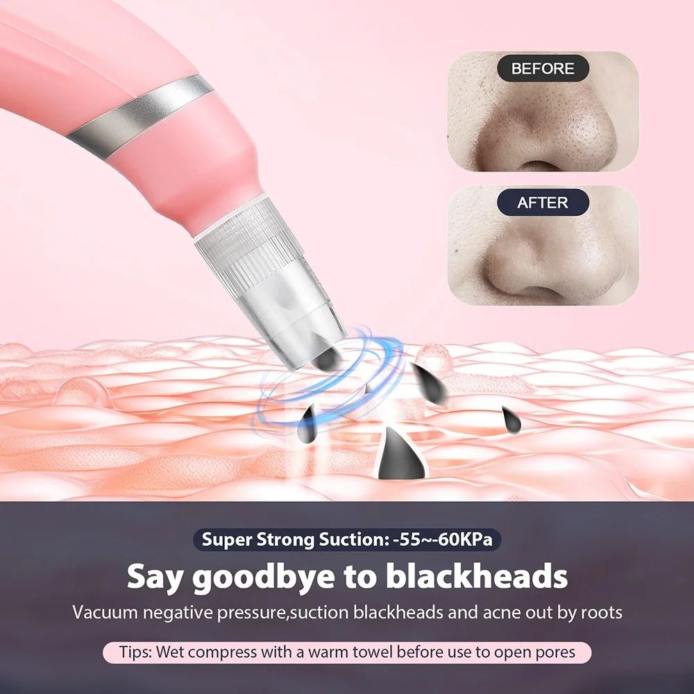 Diamond Facial Device | Microdermabrasion & Blackhead Remover