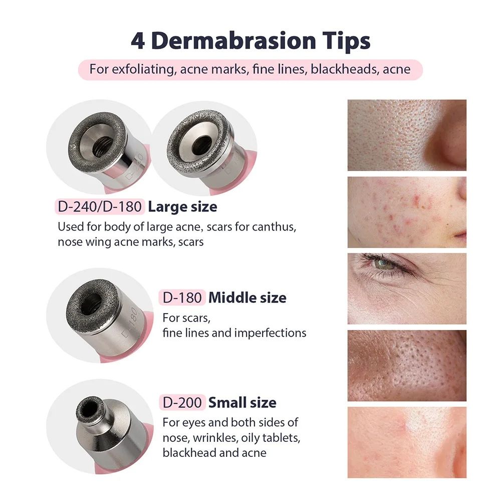 Diamond Facial Device | Microdermabrasion & Blackhead Remover