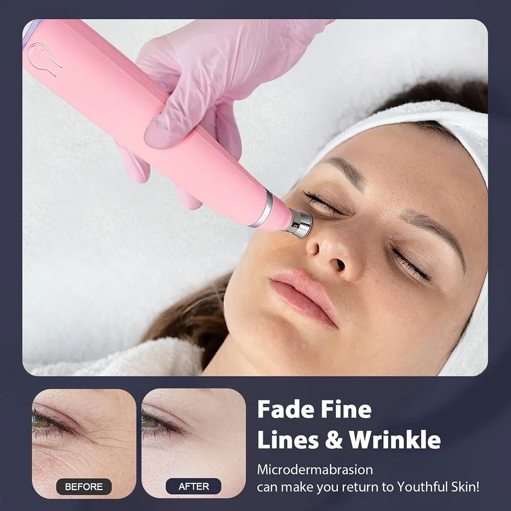 Diamond Facial Device | Microdermabrasion & Blackhead Remover