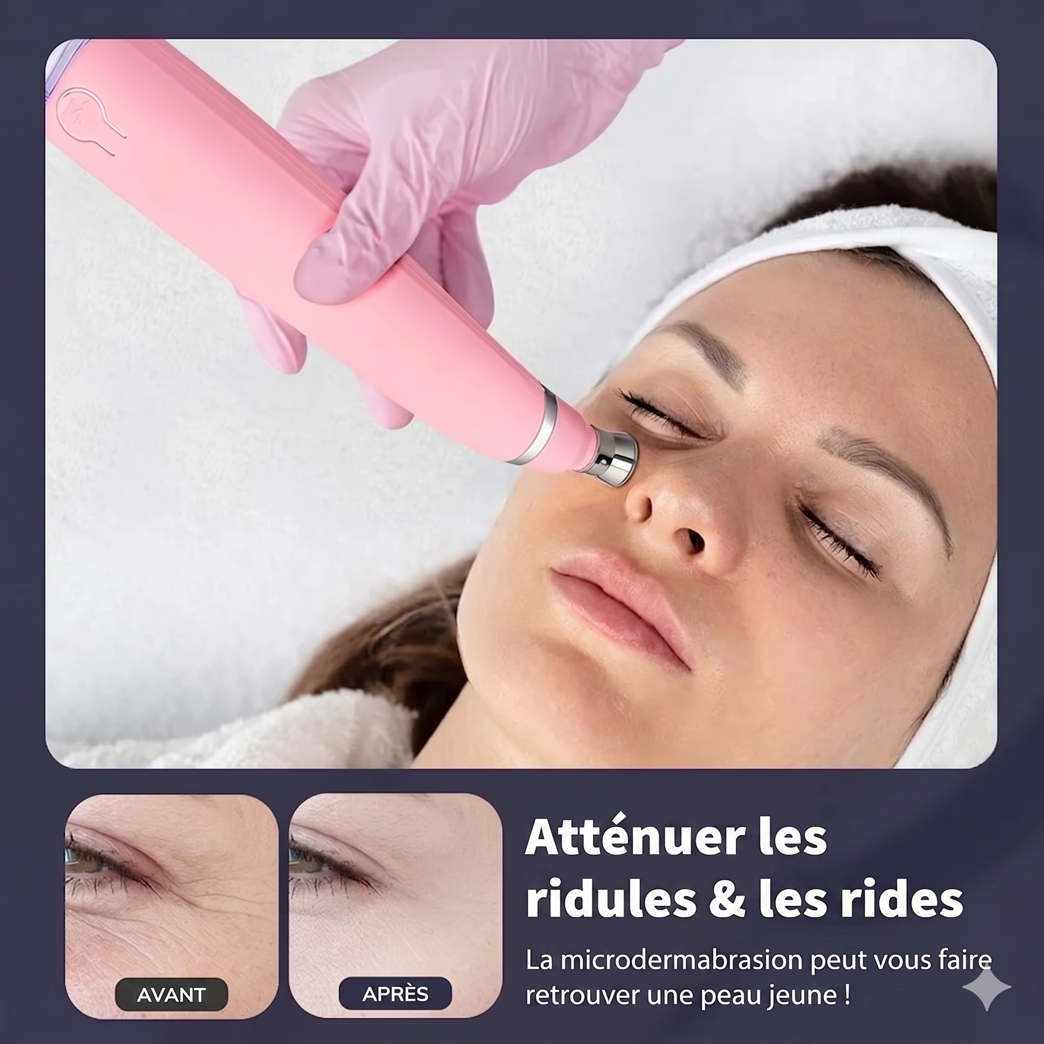 Appareil facial diamant | Microdermabrasion et éliminateur de points noirs