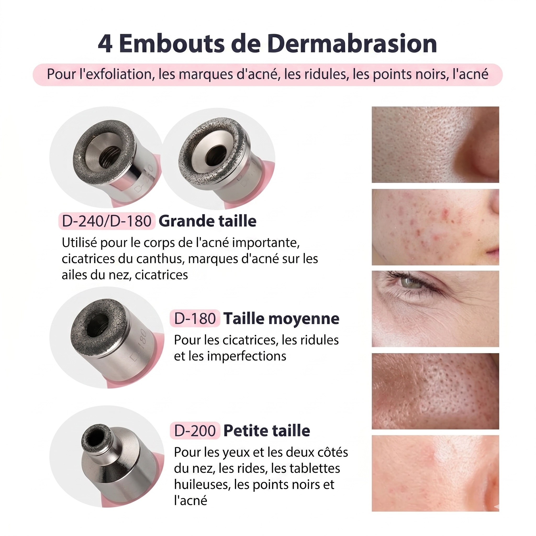 Appareil facial diamant | Microdermabrasion et éliminateur de points noirs