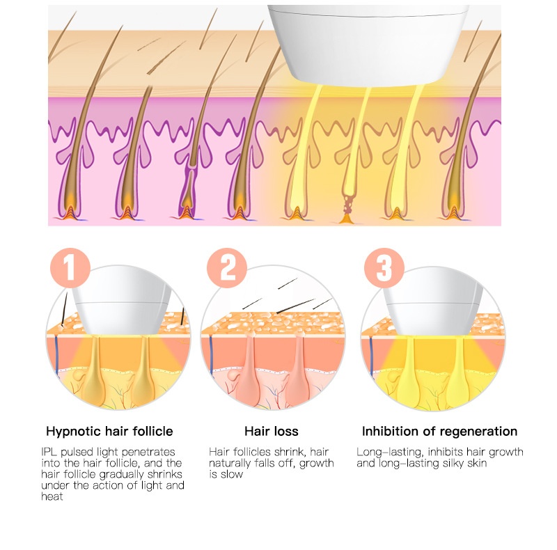 IPL Laser Hair Removal Device for Women & Men, 600K Flashes
