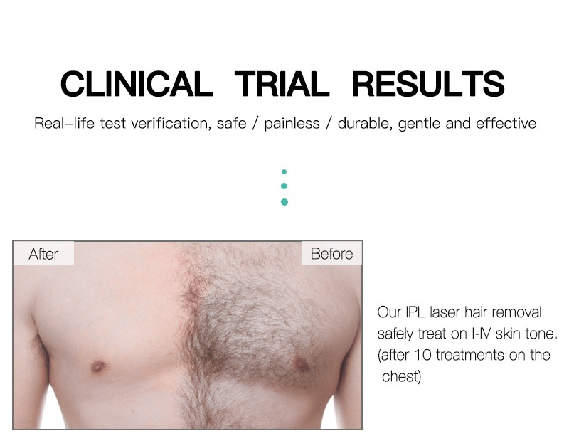 IPL Laser Hair Removal Device for Women & Men, 600K Flashes