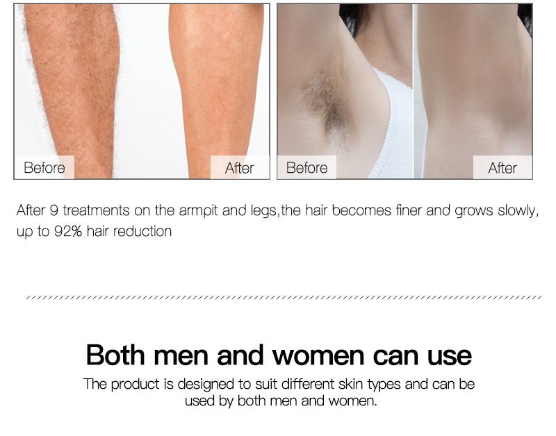 IPL Laser Hair Removal Device for Women & Men, 600K Flashes