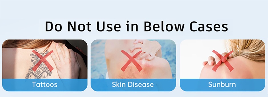 IPL Hair Removal Handset, Permanent & Painless At-Home Use
