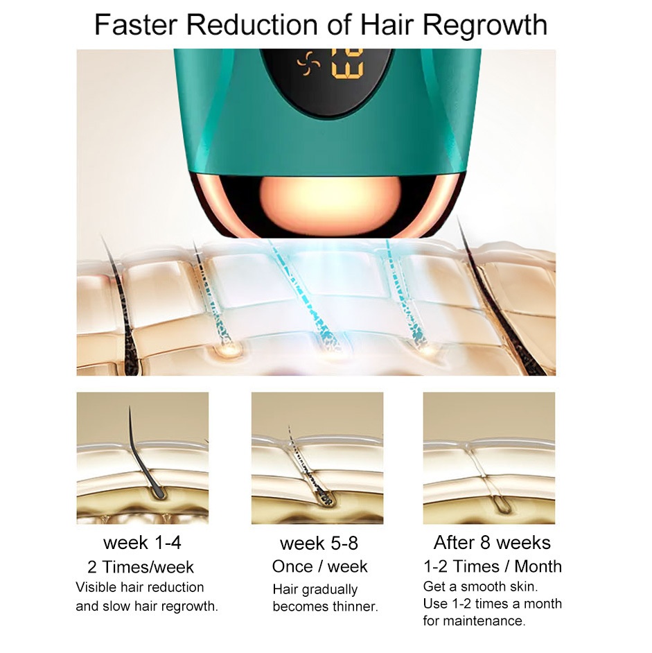 IPL Hair Removal Handset, Permanent & Painless At-Home Use