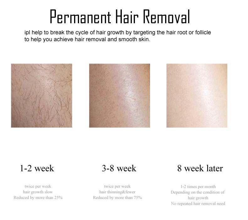 3-in-1 IPL Hair Removal Device, 900K Flashes, 8 Levels