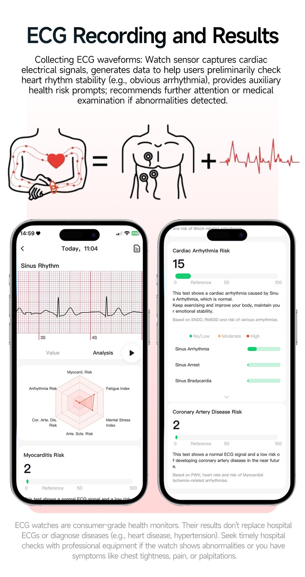 ET571 Health Smart Watch with Square Display, ECG & Bluetooth Calling