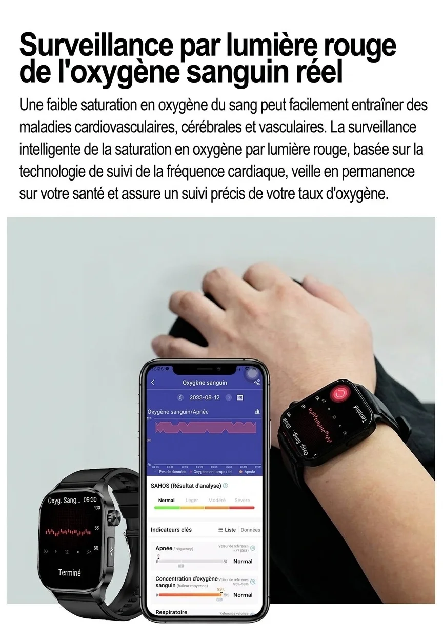 Montre connectée ECG avancée avec écran AMOLED carré et appels Bluetooth