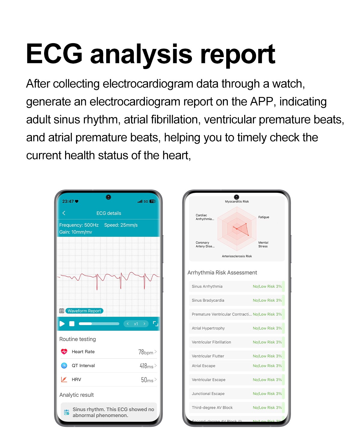 Curved AMOLED Smart Watch with ECG, Blood Pressure & Fitness Tracker