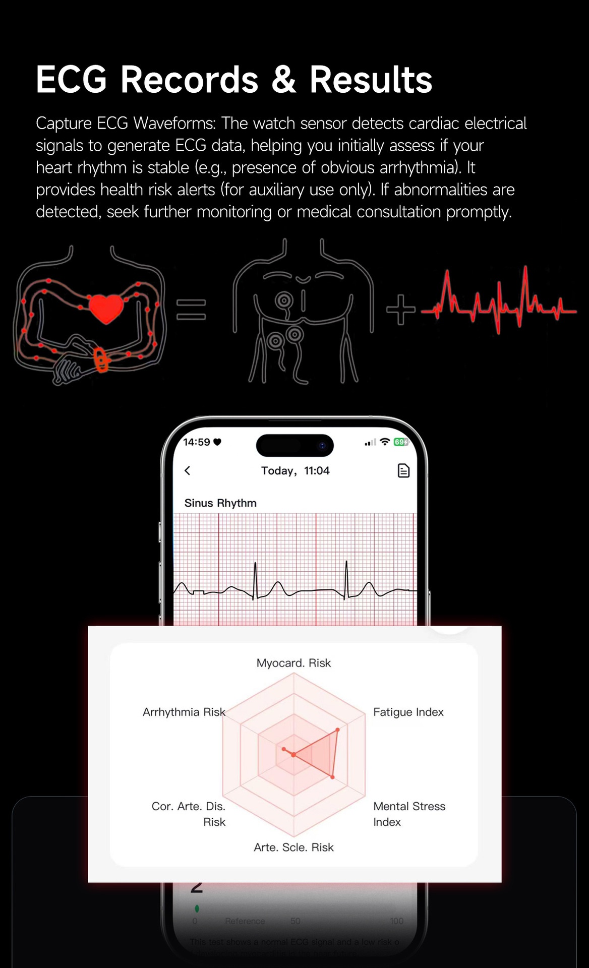 Screenless Smart Health Tracker Band with ECG, Heart Rate & SpO2