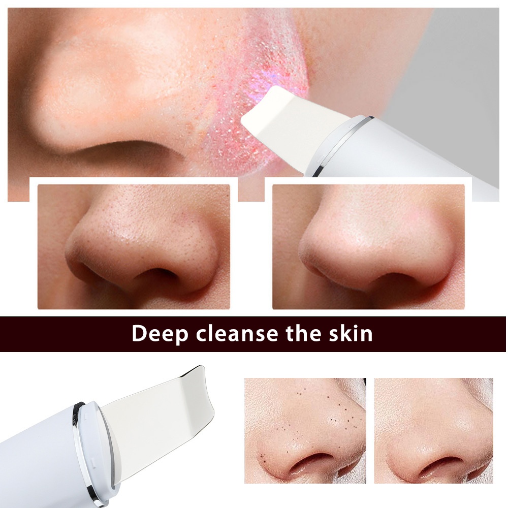 Ultrasone huidscrubber - Dieptereiniger voor poriën en liftend effect