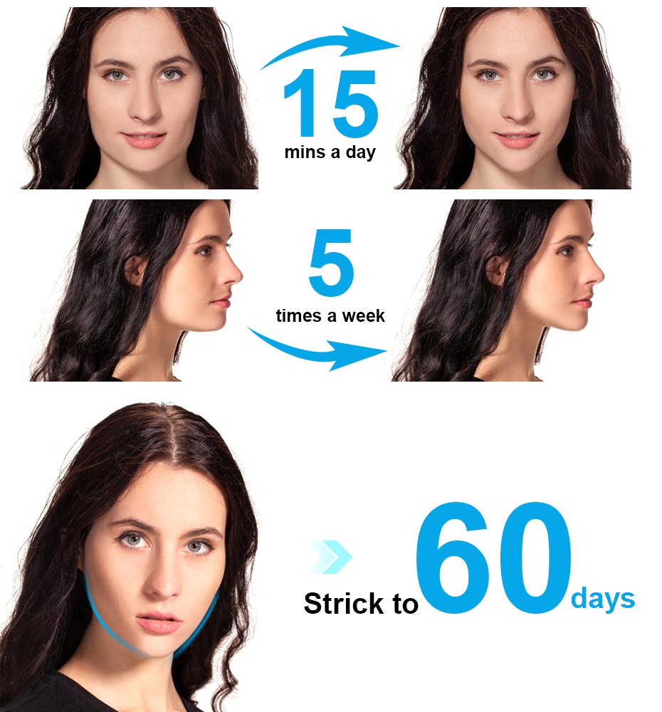 V-Face EMS Mikrostrom-Gesichtsmassagegerät – Kinnlifting-Gerät