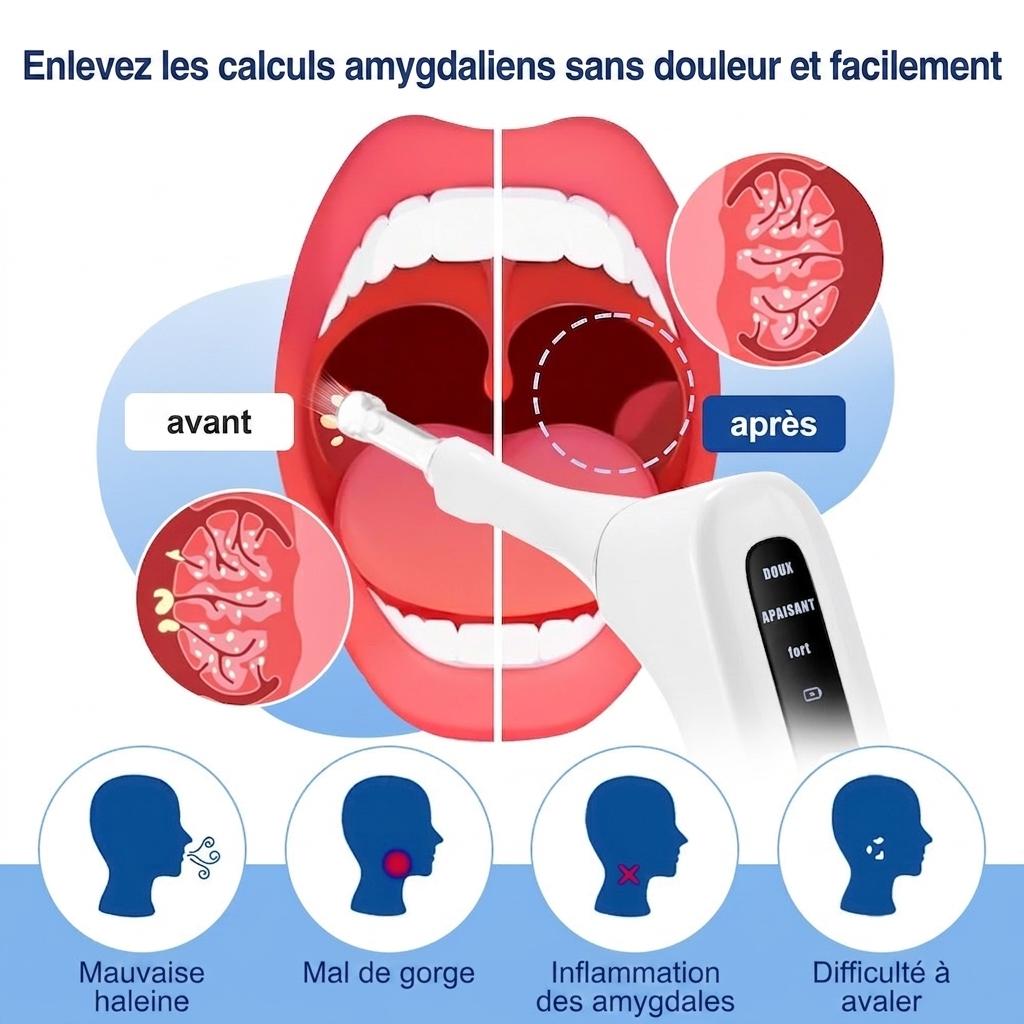 Extracteur de calculs amygdaliens avec lumière LED et aspiration