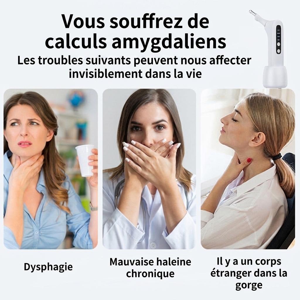 Extracteur de calculs amygdaliens avec lumière LED et aspiration