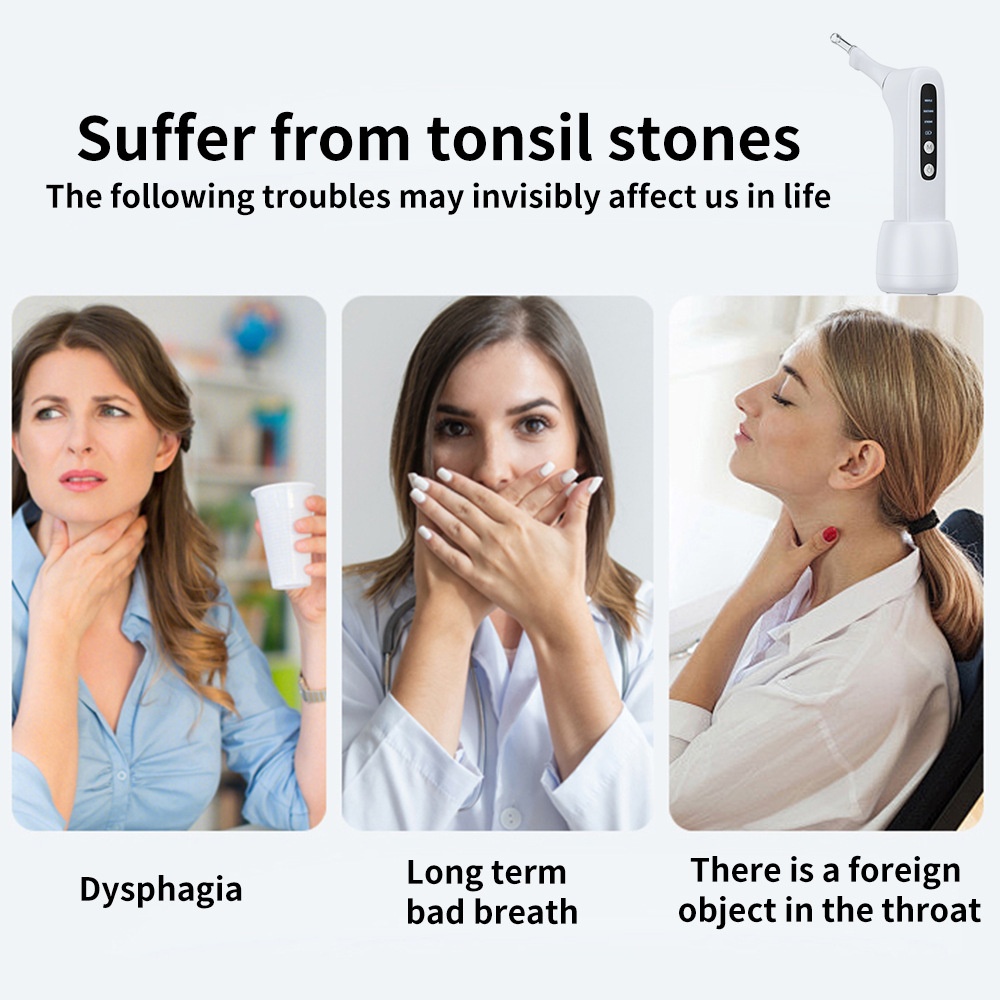 Tonsil Stone Remover with LED Light & Suction