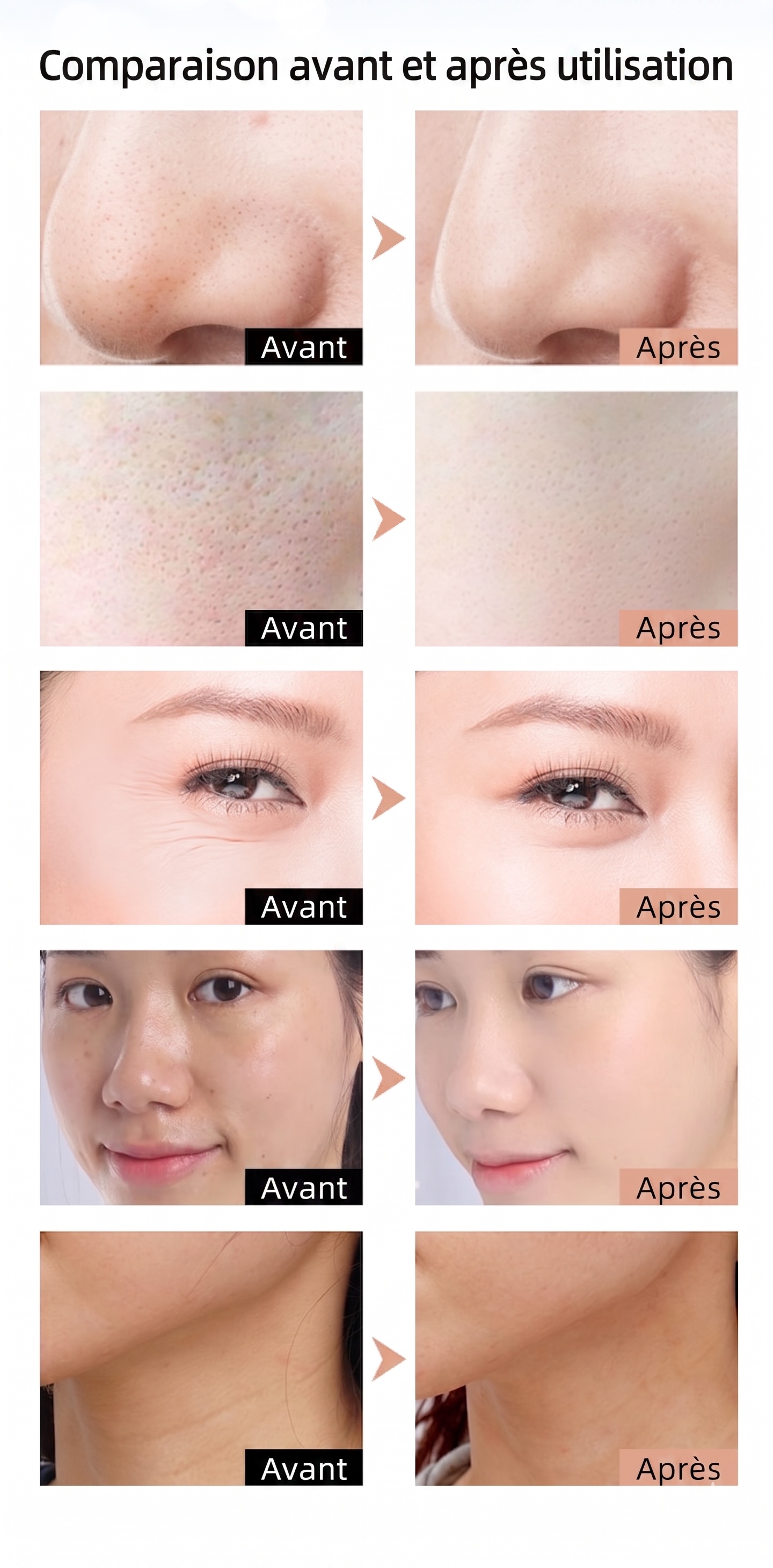 Masque portable de rajeunissement de la peau par photons LED pour le visage