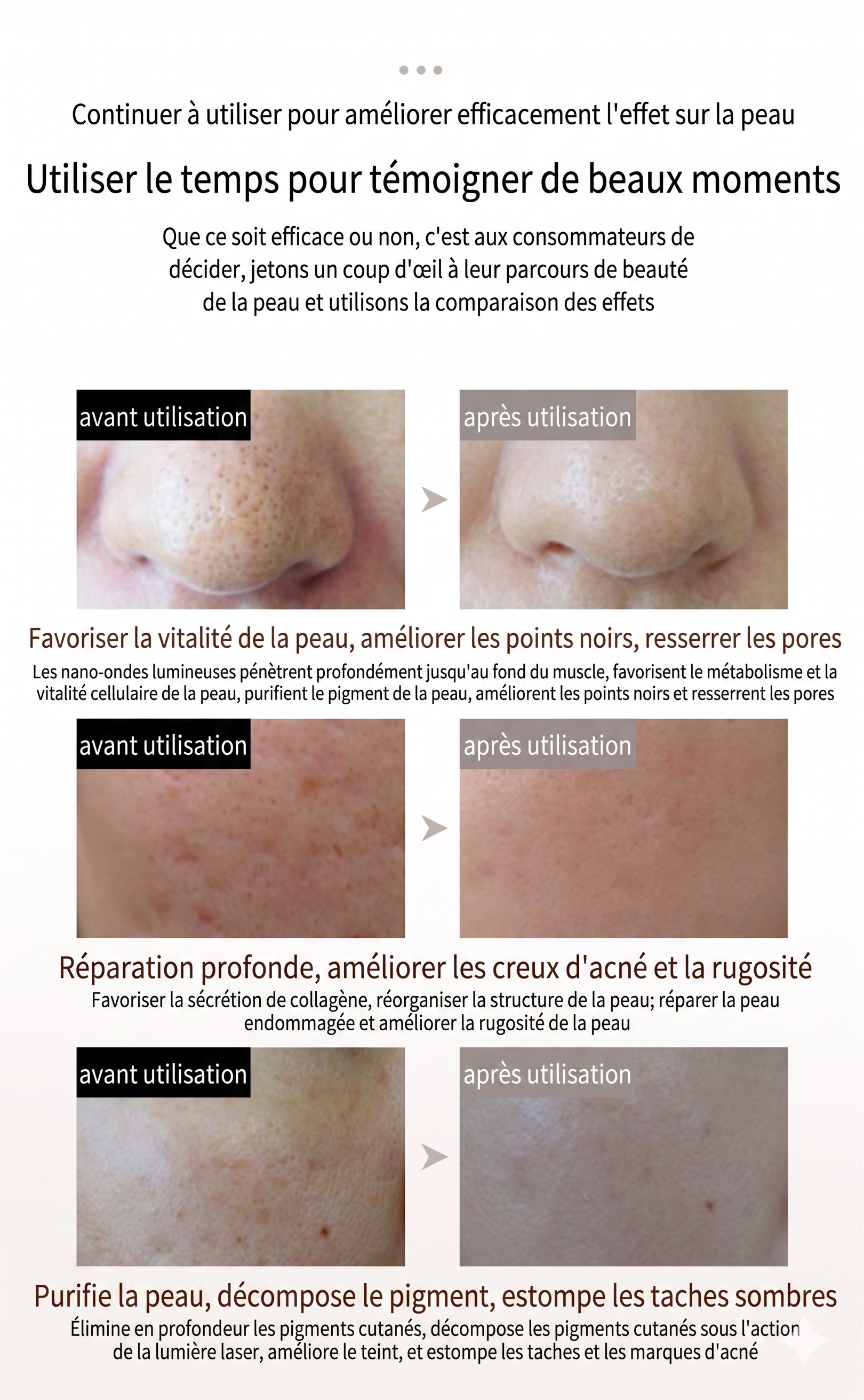 Masque facial de luminothérapie LED - Rajeunissement de la peau par 7 couleurs